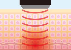 株式会社未来テック | ライズトロンNX