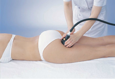 スーパーセルム 痩身 エステ機器 伊藤超短波 | 自費治療移行Navi