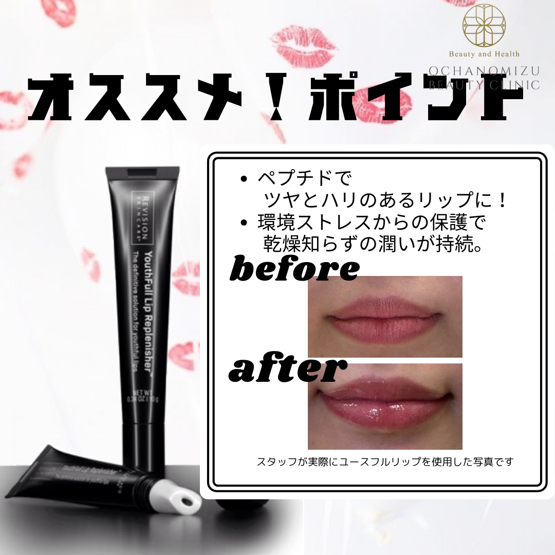 Happy Valentine ユースフルリップのご紹介 | 東京の美容皮膚科・外科