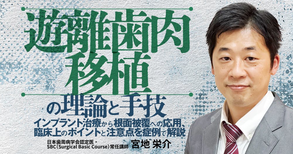 歯に優しいけどムズかしい、接着ブリッジの臨床論。デザイン・形成の