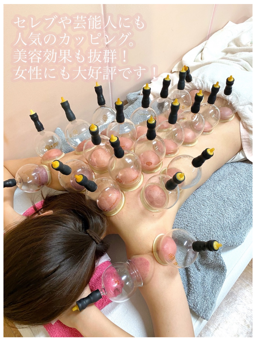 吸玉療法 | とやま鍼灸整骨院（熊本県大津町）