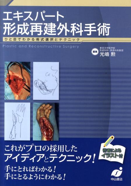 裁断済】エキスパート形成再建外科手術 : ひと目でわかる術式選択と