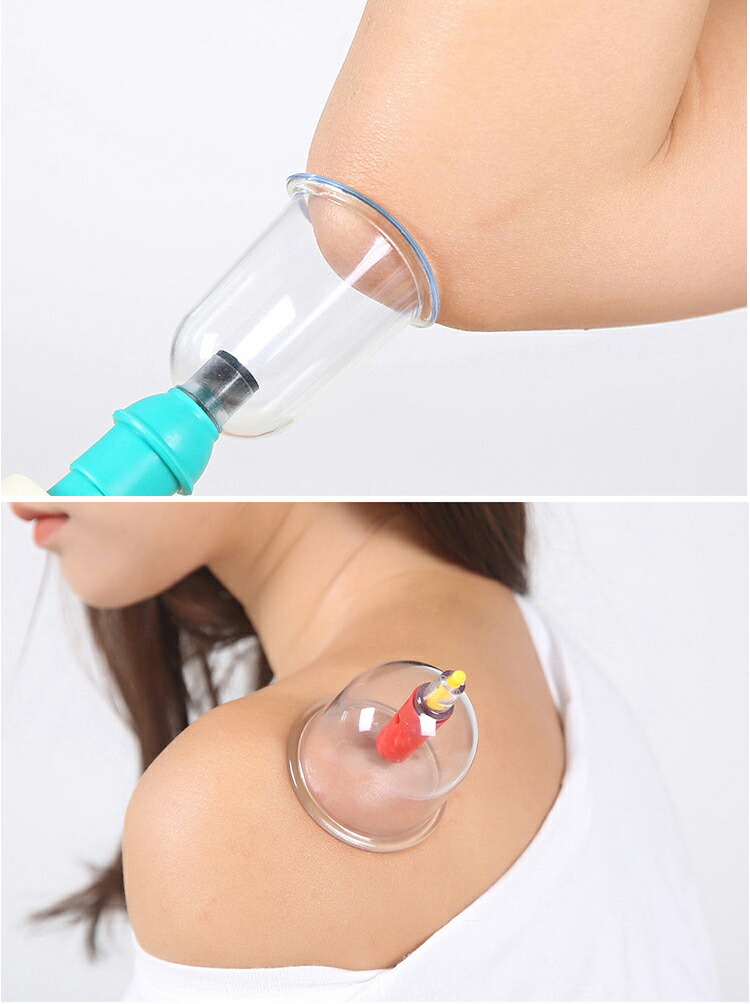 楽天市場】【☆マラソンセール☆全品10%OFF】吸玉 カッピング 吸い玉