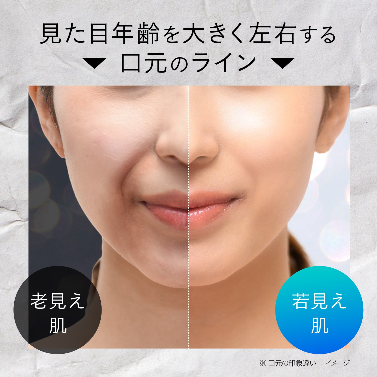 楽天市場】【公式】クオニス ダーマフィラー スマイル 6回分｜ほうれい