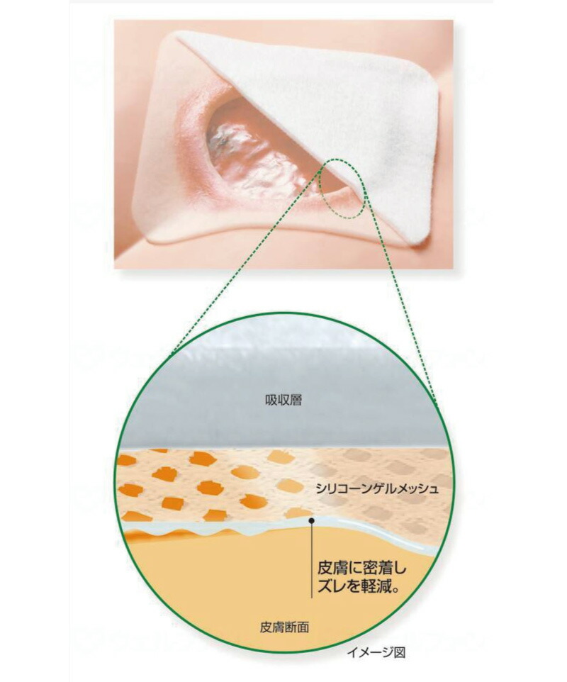 楽天市場】エスアイエイド 3枚入 7号 100×200mm アルケア 創傷用