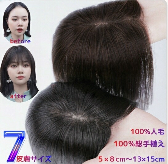 楽天市場】人毛100% 部分ウィッグ 頭頂部 トップカバー 前髪ウィッグ