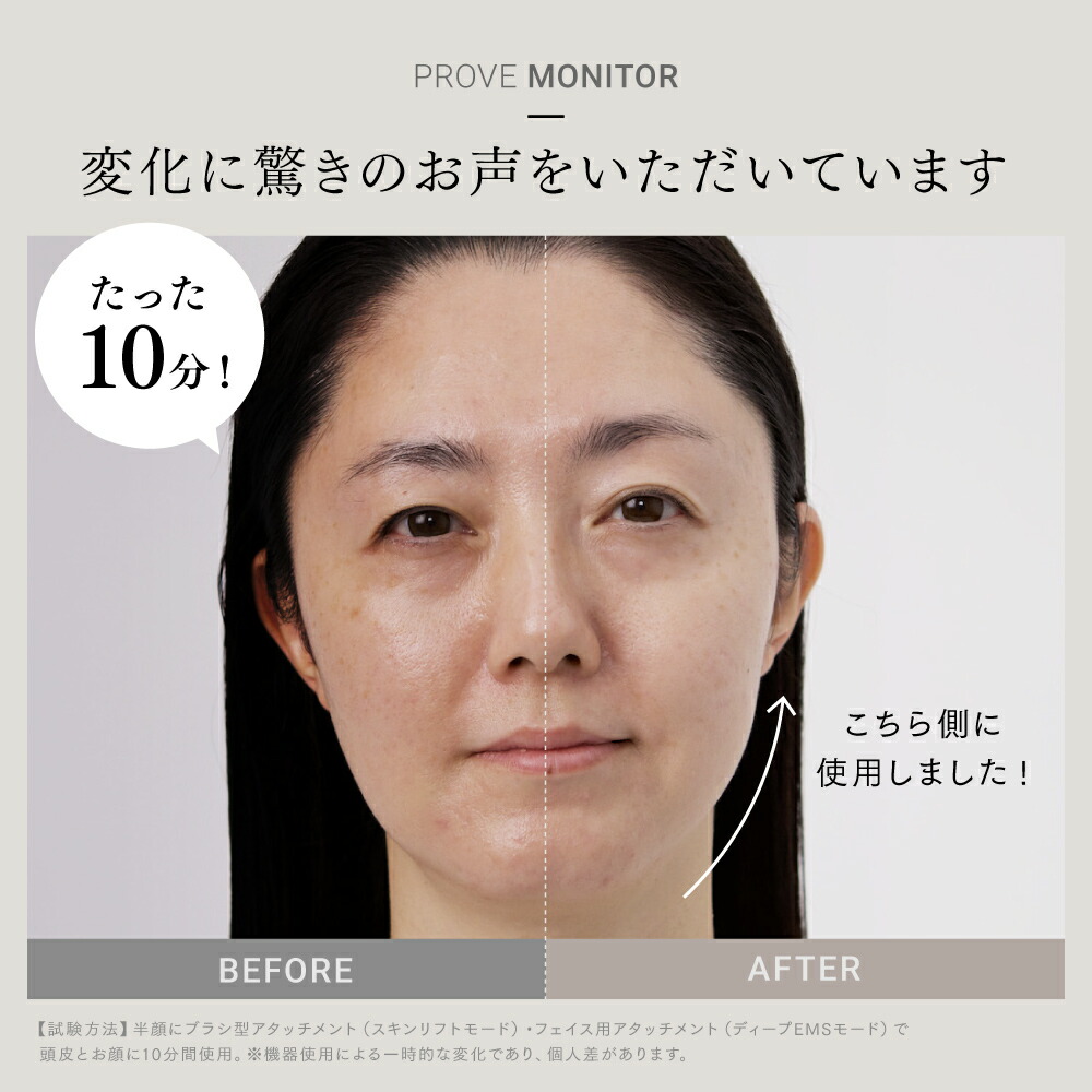 MYTREX 美顔器 & 専用ジェルセット ホワイト MYTREX 美顔器 & 専用