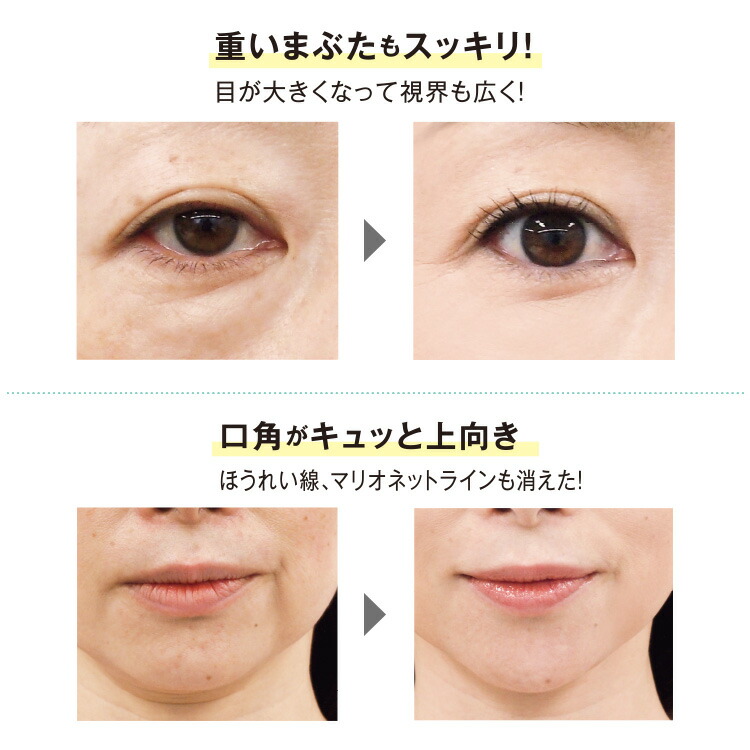 楽天市場】【送料無料】リフトアップテープ かづき・デザインテープ [5