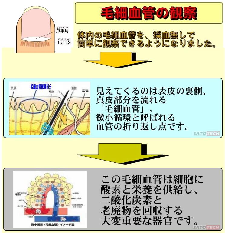 血流スコープ（ゴースト血管スコープ）の血流観察のポイント 測定器の