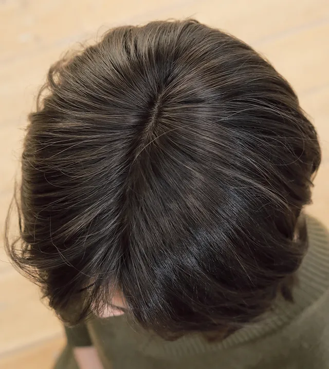 医療用ウィッグストーリー｜ミディアム｜モダニティロブ