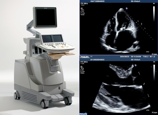 小田原市 | 心エコー検査(経胸壁・経食道)