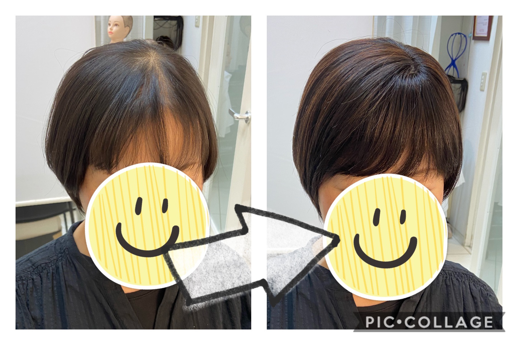 手軽に簡単に♡分け目用トップピース♡ | 抗がん剤治療後のヘアケア