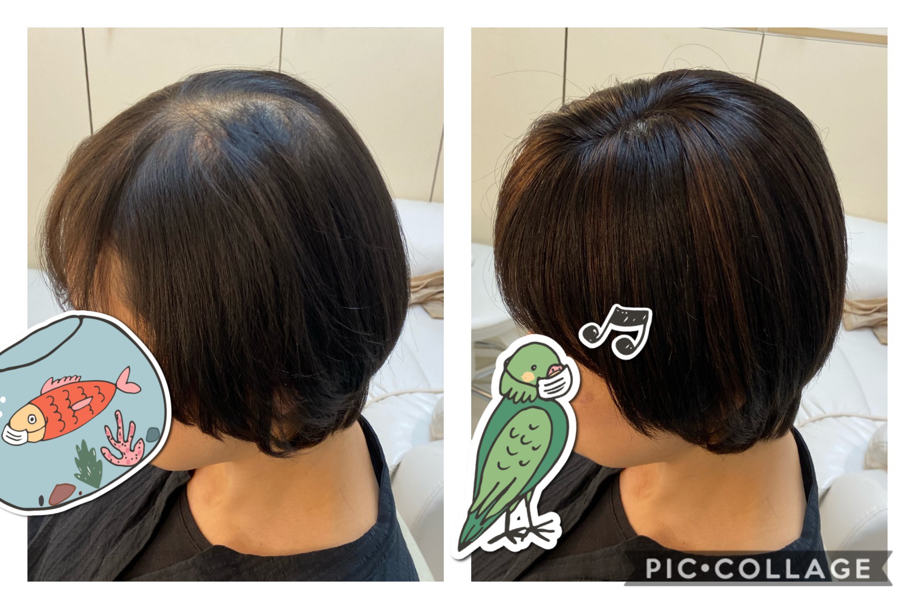 手軽に簡単に♡分け目用トップピース♡ | 抗がん剤治療後のヘアケア