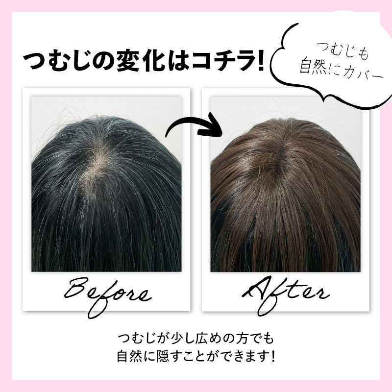 部分ウィッグ】 ナチュラル［ナチュラルブラック］プチリタッチ