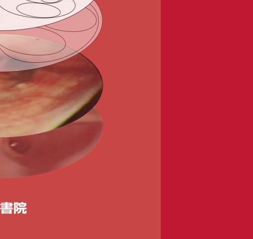 末梢病変を捉える 気管支鏡“枝読み”術 [DVD-ROM（Windows版）付] 第2版