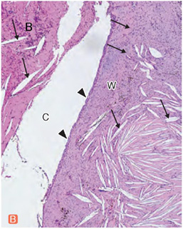 新口腔病理学 第3版 正誤表／補足情報／医歯薬出版株式会社
