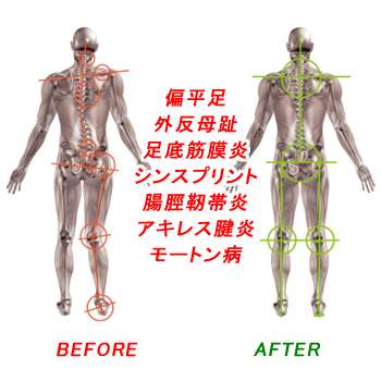 NWPL社 ファンクションオーソティクス インソール Life OTC (ライフ