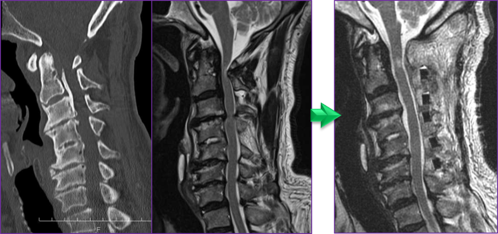 脊椎脊髄外傷 | 町田の脳神経外科・脊髄外科・神経内科「町田脳神経外科」
