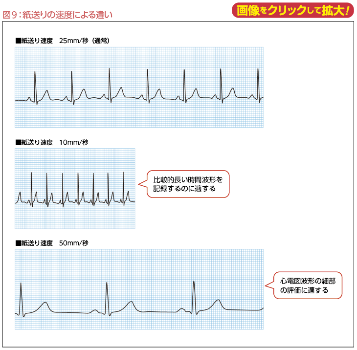 ステップアップで理解する心電図講座【Web解説】