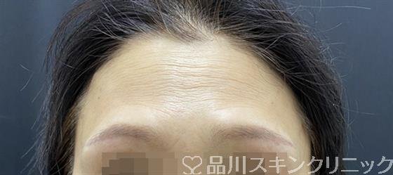 新屋 剛広 | 品川美容外科 症例サイト