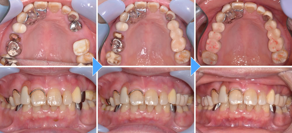 顎関節症の改善・咬み合わせ治療｜巣鴨駅1分の巣鴨S歯科矯正歯科