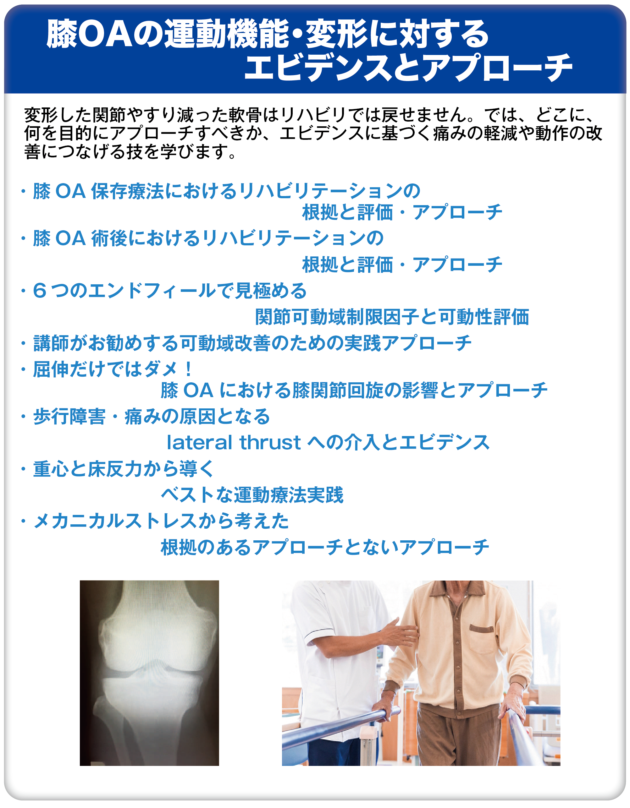 根拠がわかる整形/運動器疾患へのアプローチ 膝OAの運動機能・変形