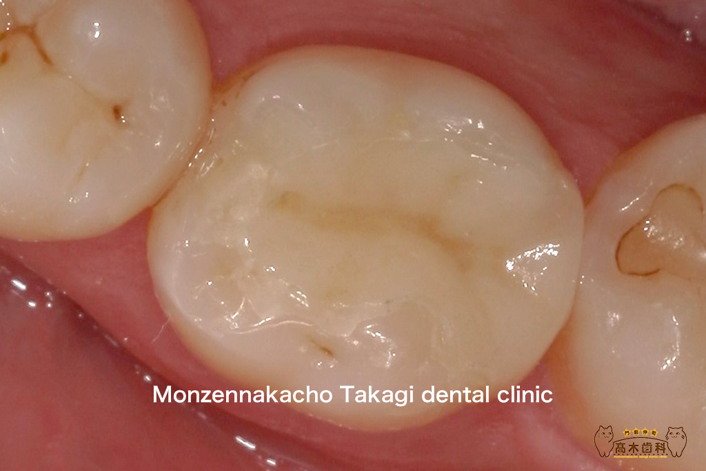 審美歯科｜門前仲町・木場の歯医者【門前仲町髙木歯科】