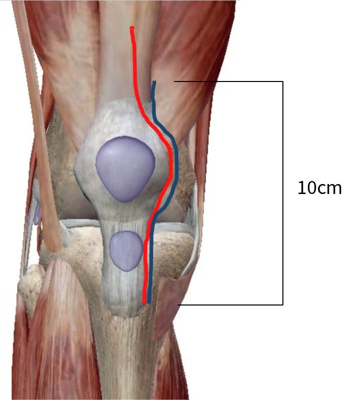 膝関節の症状や痛みの原因、最新の手術方法について医師が徹底解説
