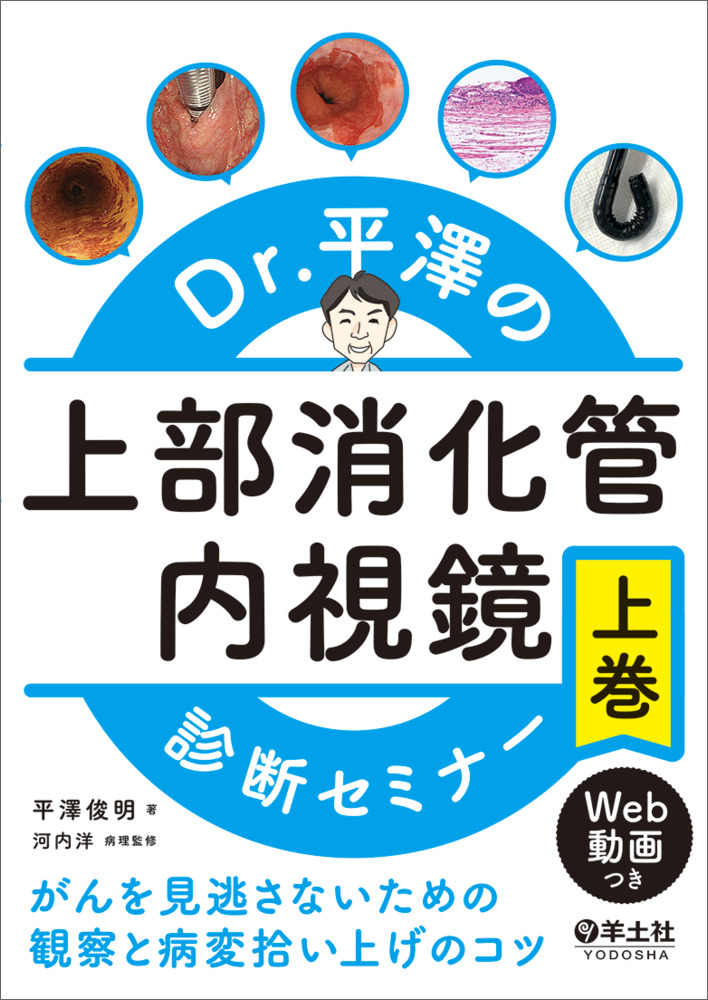 Dr.平澤の上部消化管内視鏡診断セミナー 上巻〜がんを見逃さないための