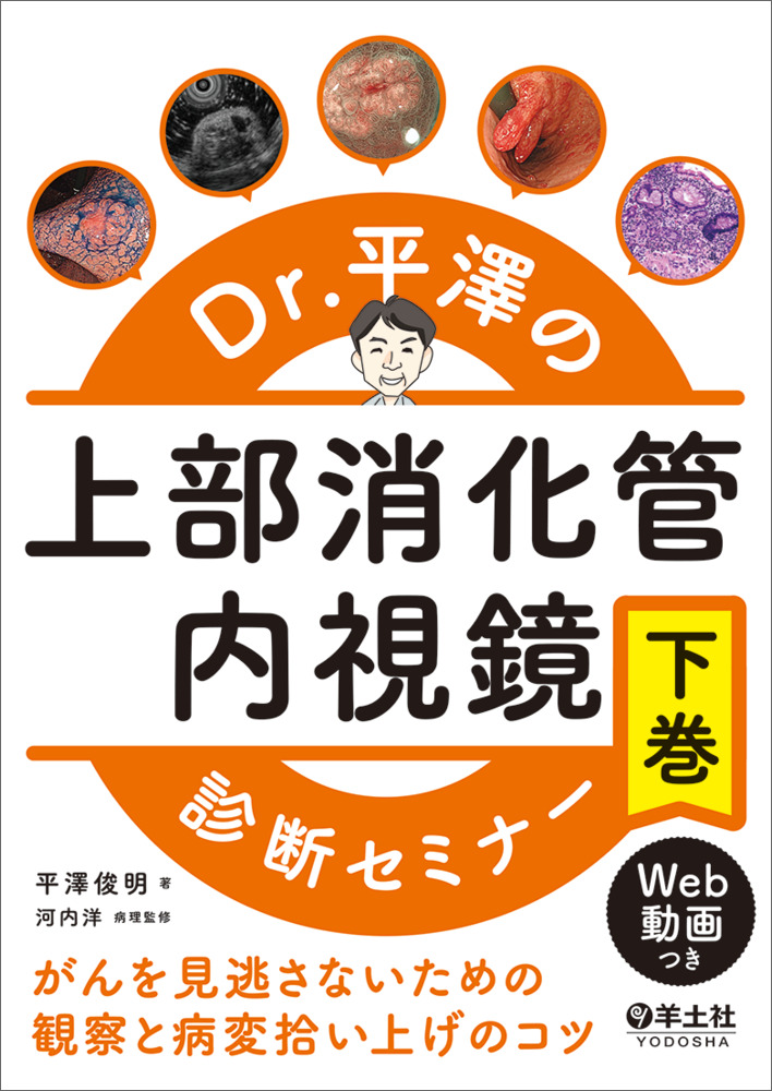 Dr.平澤の上部消化管内視鏡診断セミナー 下巻〜がんを見逃さないための