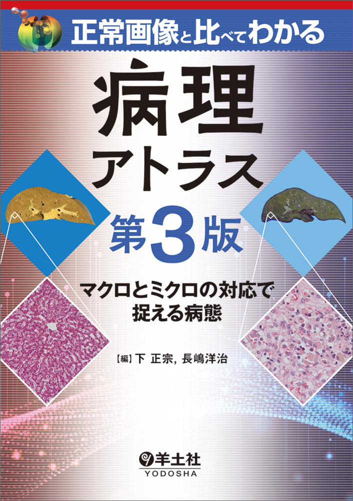 正常画像と比べてわかる 病理アトラス 第3版〜マクロとミクロの対応で
