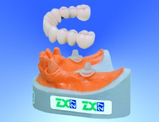 For Professionals – ZX-27 – Non-Surgical Dental Implants Alternative