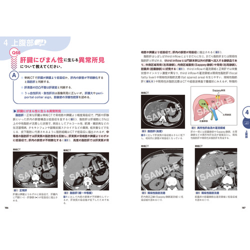 Gakken KEYBOOKビギナーズ|CT診断一問一答|村上卓道(編