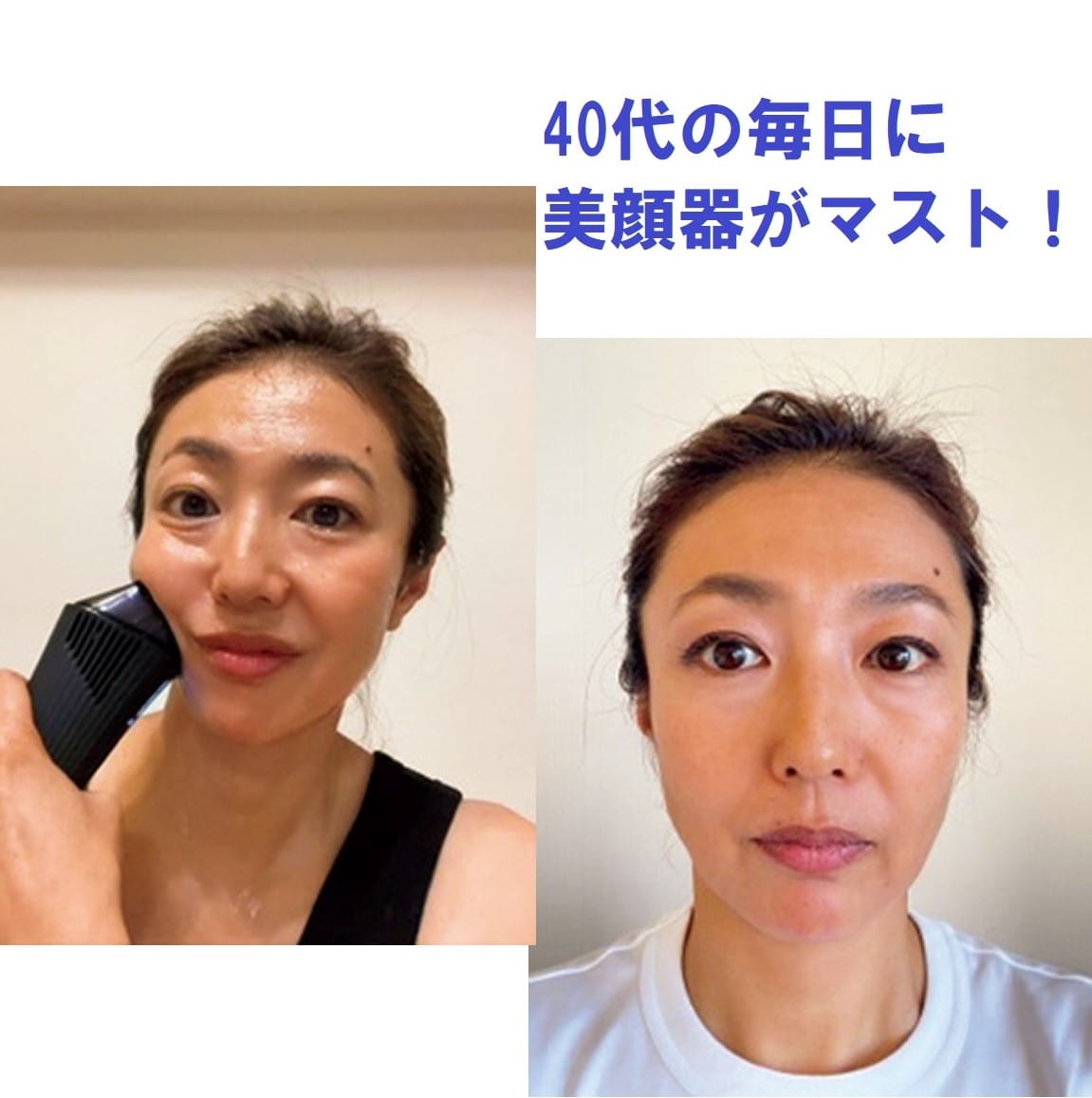 40代美容【ファンデ薄塗りでもキレイ】大人気の美顔器［ReFa ダーマ