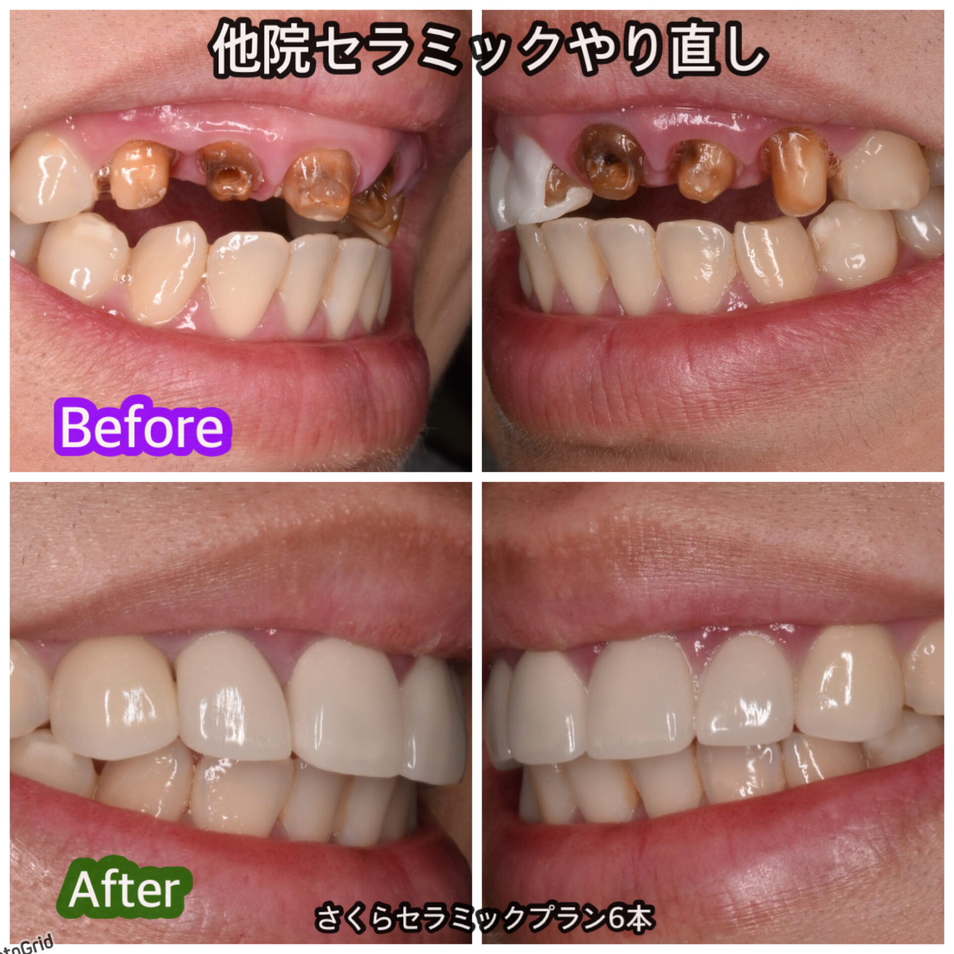 3月, 2026 | 名古屋市の歯医者は「ひめみやさくら歯科矯正歯科」