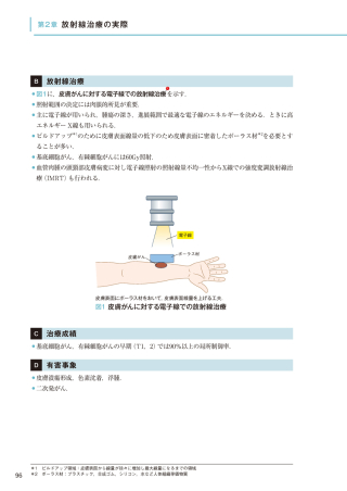 やさしくわかる放射線治療学改訂第2版』 ｜ 学研出版サイト