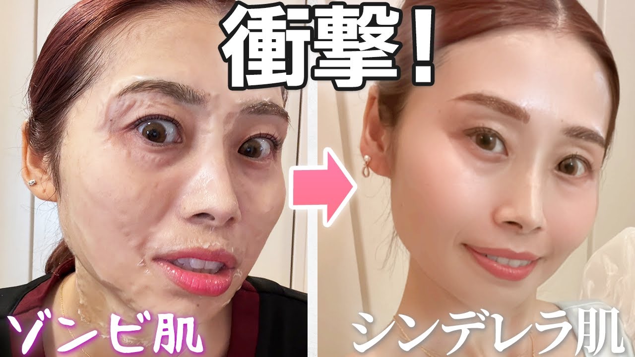Shocking! From zombie skin to Cinderella skin! Addresses age spots