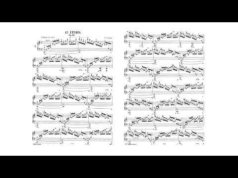 Chopin: Études (Complete) ― Idil Biret [+ Sheet Music]／쇼팽