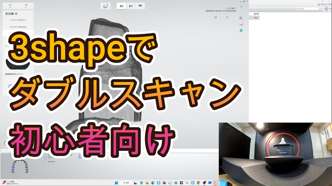 3shapeでジルコニアクラウン設計「ダブルスキャン」 - YouTube