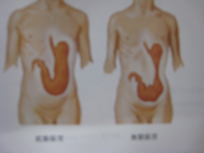 胃下垂患者を紹介してくれた同級生 | 大阪オステオパシーセンター