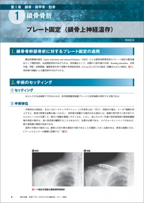骨折治療 手術アプローチがよくわかる髄内釘・プレート固定 : 渡部欣忍