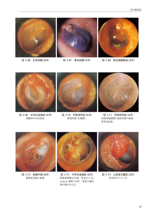 新耳鼻咽喉科学 切替 一郎(原著) - 南山堂 | 版元ドットコム