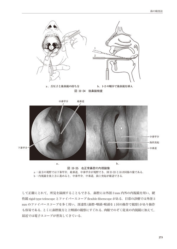 新耳鼻咽喉科学 切替 一郎(原著) - 南山堂 | 版元ドットコム