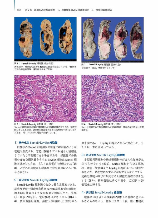 卵巣腫瘍・卵管癌・腹膜癌 改訂・改題第2版(腫瘍病理鑑別診断アトラス