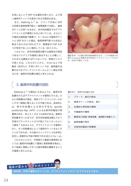 驚くほど臨床が変わる！ こだわりペリオサブノート