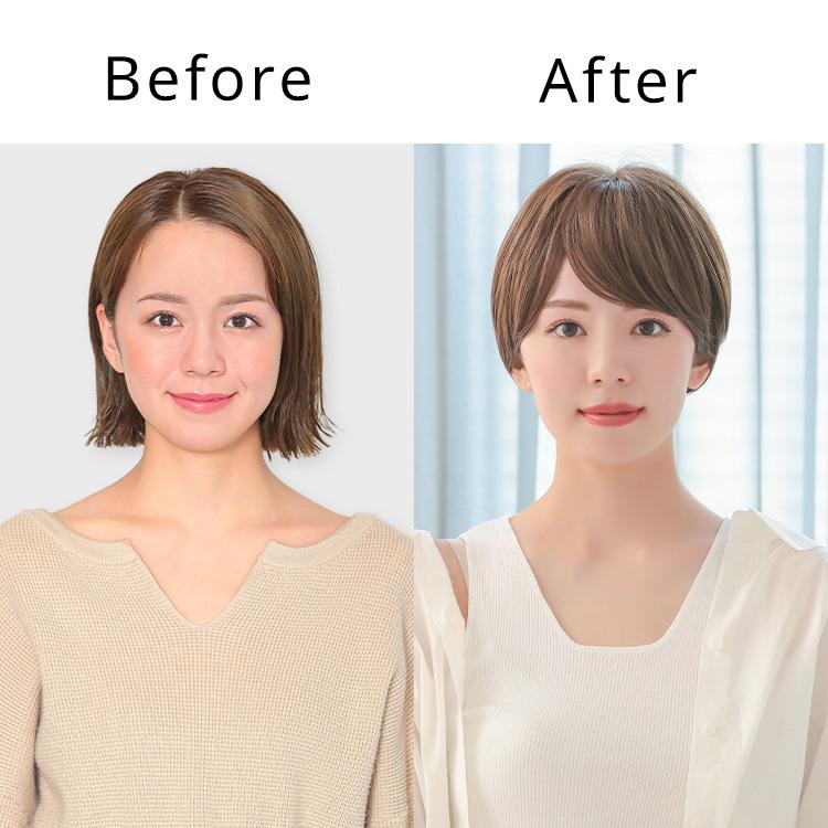 AQUADOLL（アクアドール） 医療用ウィッグ ショート 帽子ウィッグ