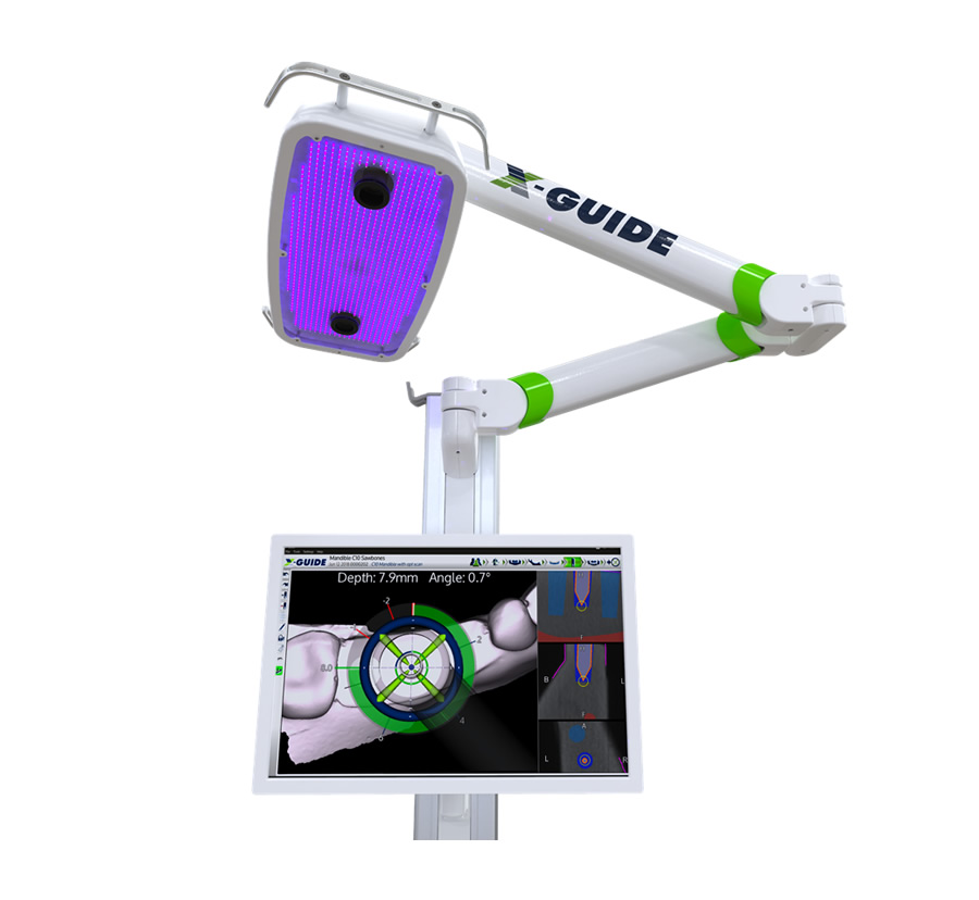 ダイナミック3Dナビゲーションシステム｜OMFC オーラル＆マキシロ