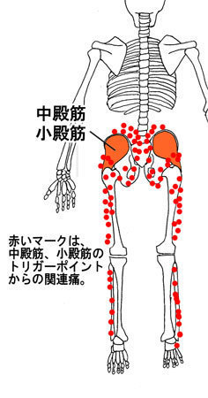 急な 痛み 疲れに効果 トリガーポイントと筋膜アプローチ - Kj北青山