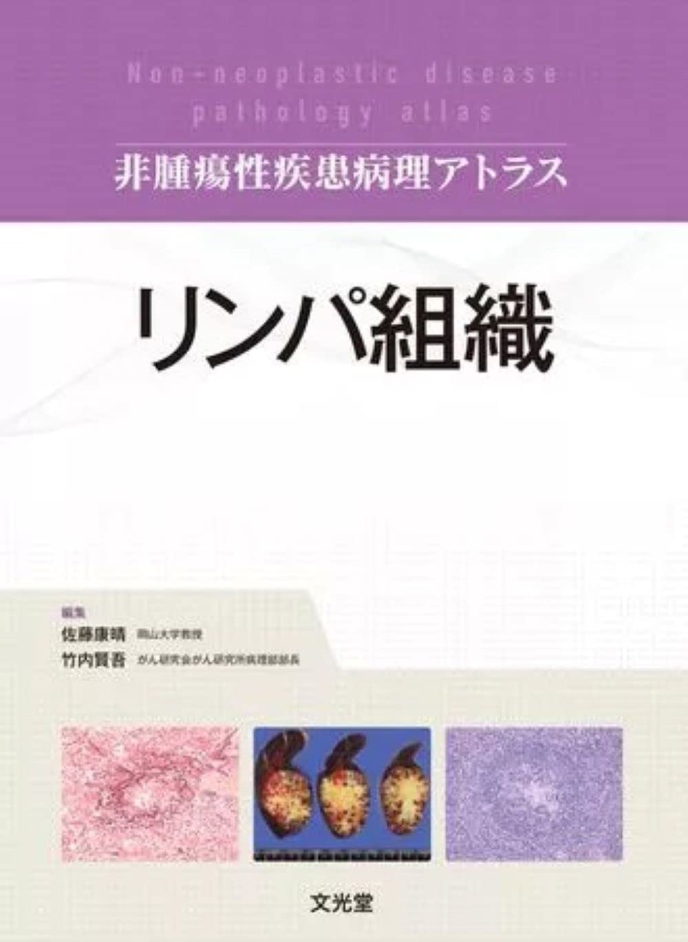 リンパ組織 (非腫瘍性疾患病理アトラス) | 佐藤康晴, 竹内賢吾 |本
