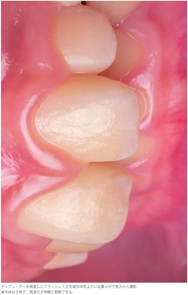 歯科技工別冊 Dental Photo Master チェアサイド・ラボサイドにおける